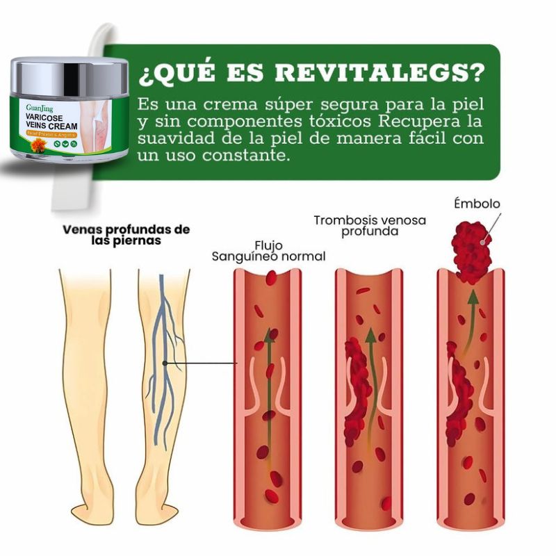 GuanJing® - Tratamiento Natural Eliminador de Varices