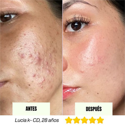 Barra Regenerativa Coreana Fresh MASK™ (Hoy 2x1)