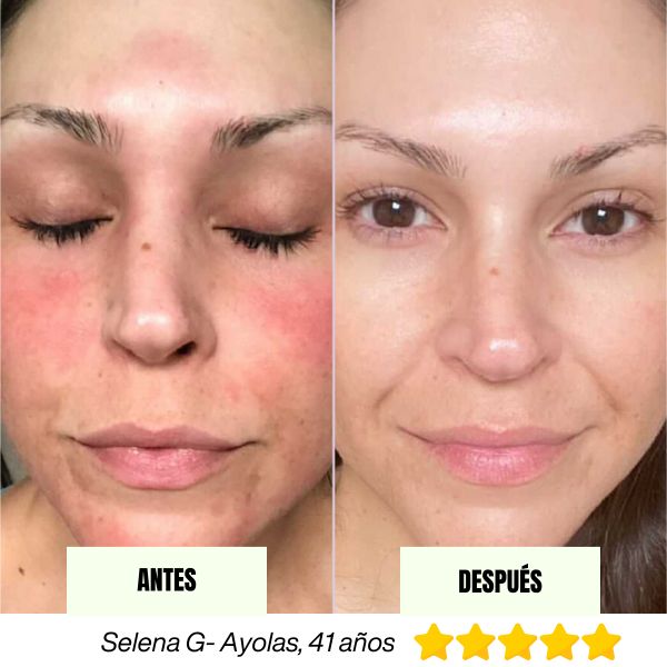 Barra Regenerativa Coreana Fresh MASK™ (Hoy 2x1)