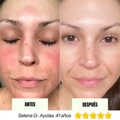 Barra Regenerativa Coreana Fresh MASK™ (Hoy 2x1)